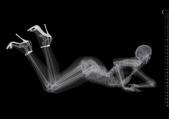Фотосессия обнаженной девушки рентгеновским аппаратом. Получилось